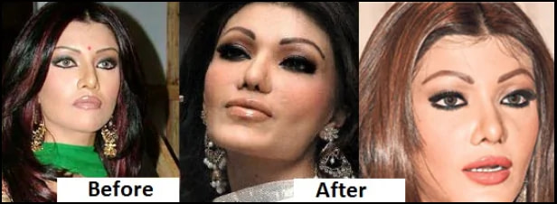 Which Bollywood actors and actresses have done cosmetic 