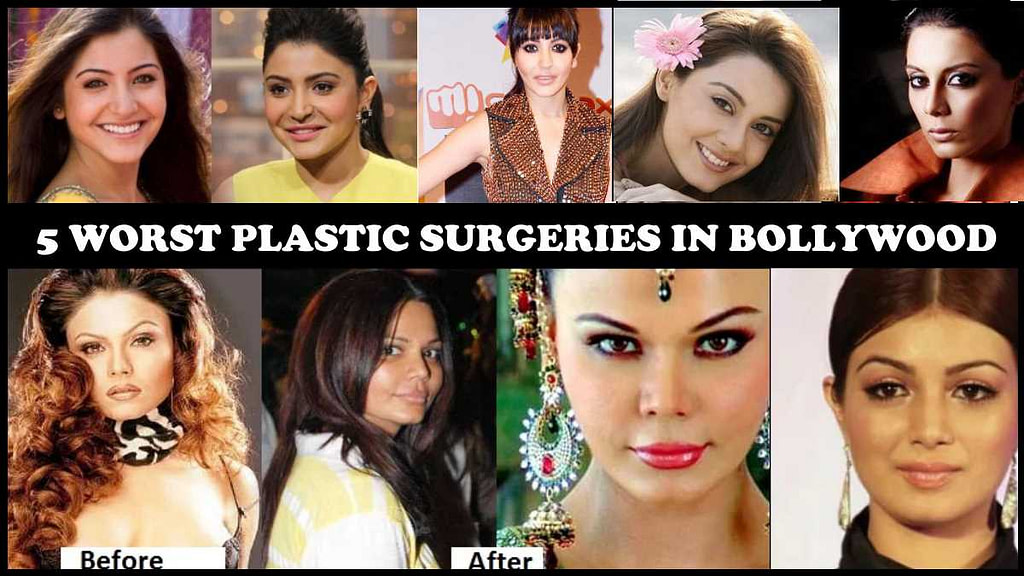 worst plastic surgeries