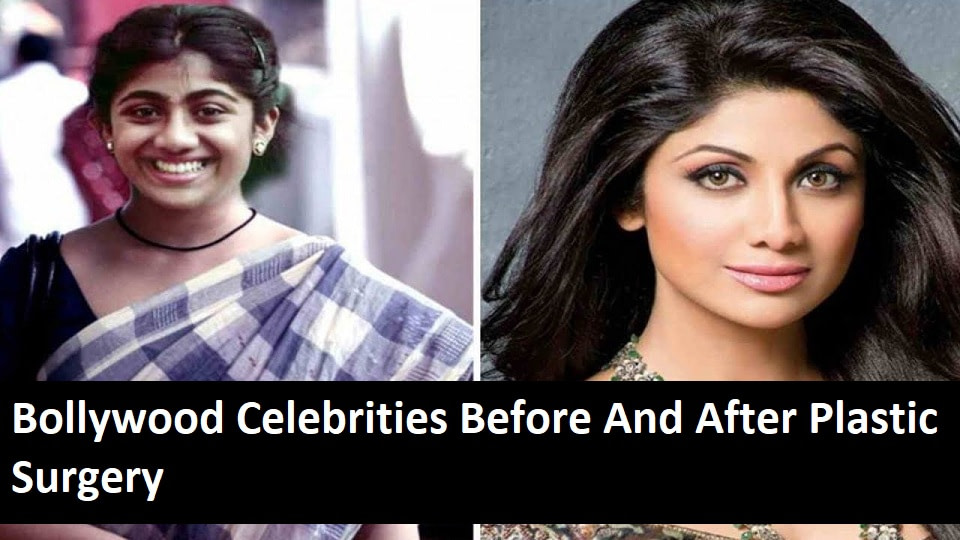 Bollywood Celebrities before and after plastic surgery